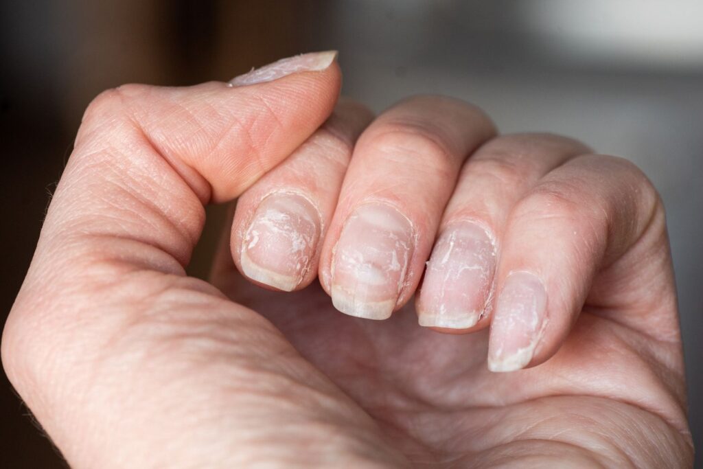 Nails break easily after 50