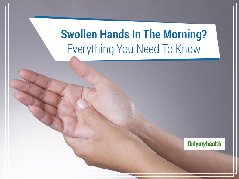 hands swell in the morning after 50 swollen fingers, stiffness in the morning