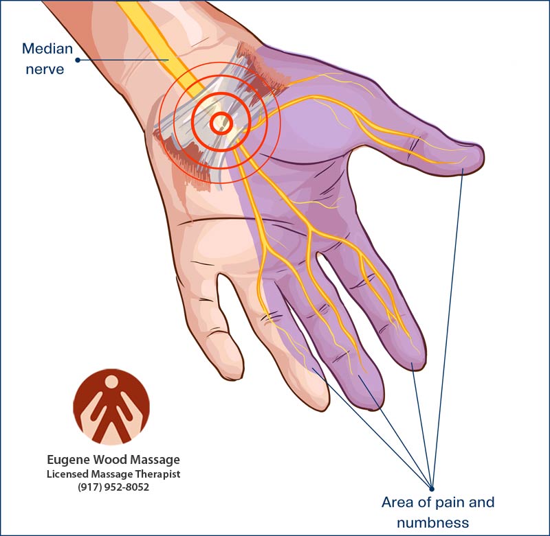hands go numb at night after 50 tingling fingers during sleep carpal tunnel symptoms at night
